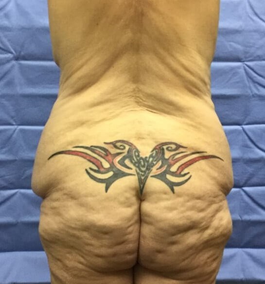 Back Before