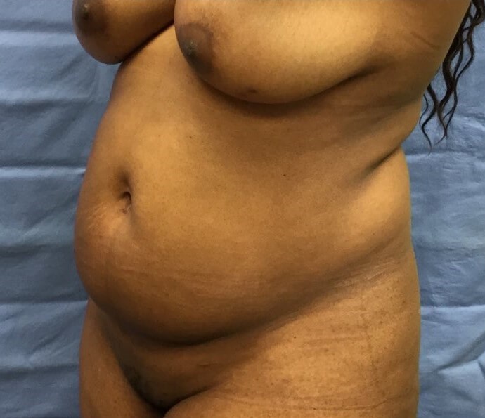 Oblique Before