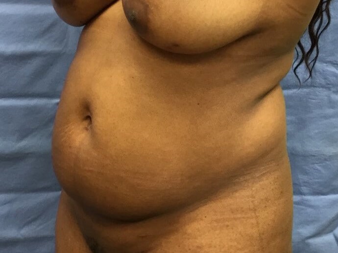 Oblique Before