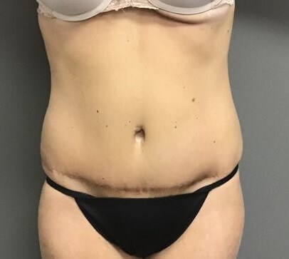 After Image