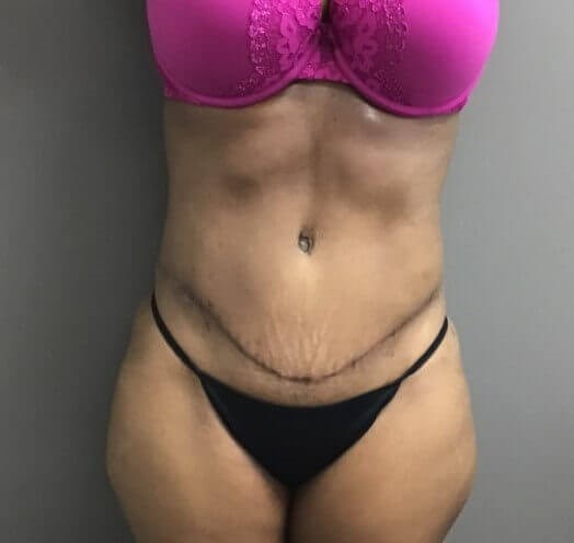 After Image