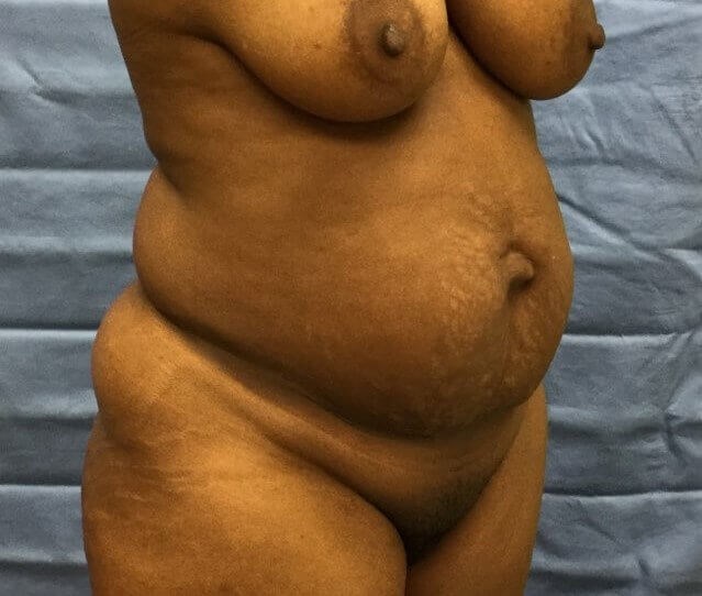 Oblique Before