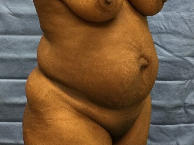 Oblique Before