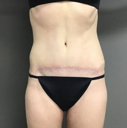 After Image