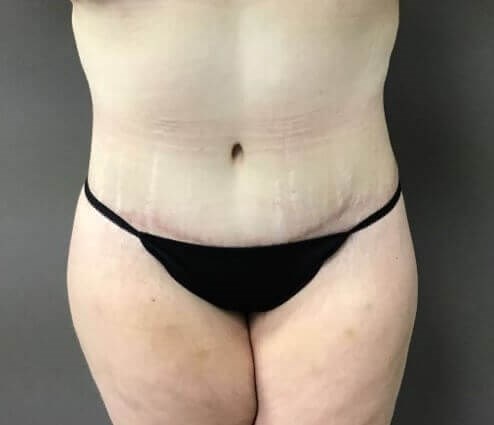 After Image