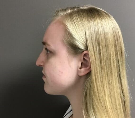 Before Image