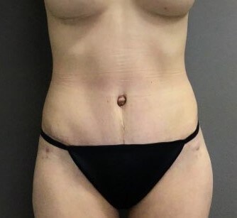 After Image