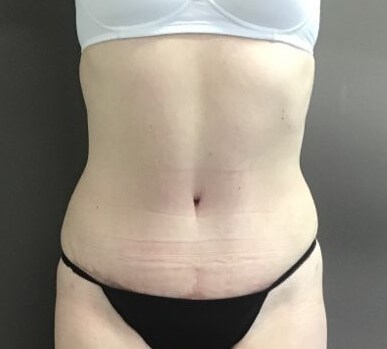 After Image
