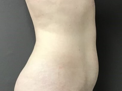 Side Before