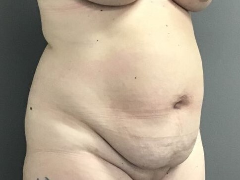 Oblique Before
