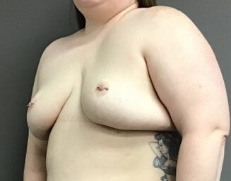 Oblique Before