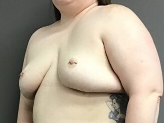 Oblique Before