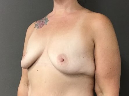 Oblique Before