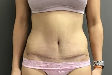 After Image