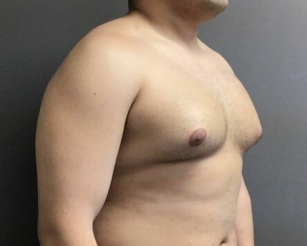 Oblique Before