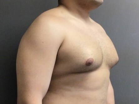Oblique Before