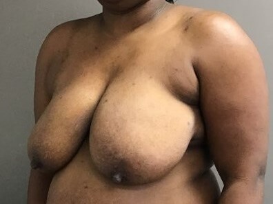 Oblique Before