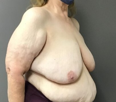 Oblique Before