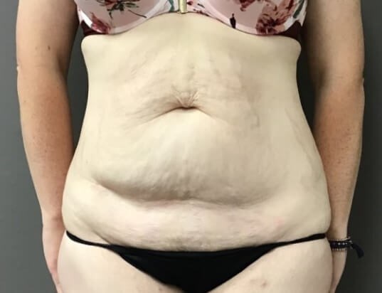 Before Image