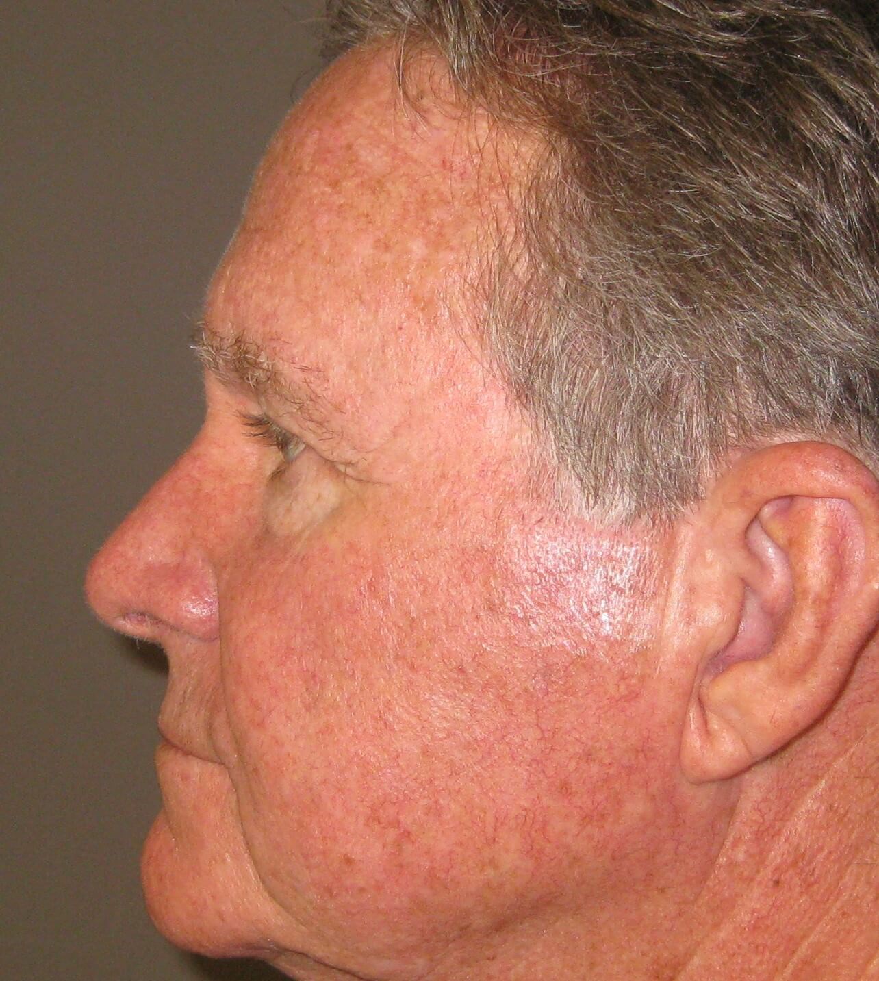 After Image