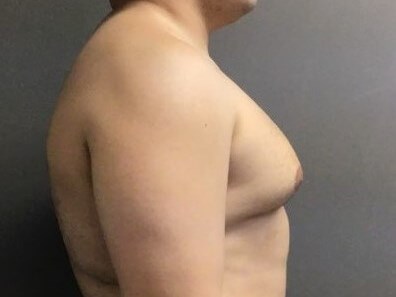 Side Before