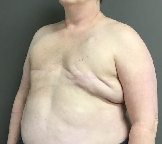 Oblique Before