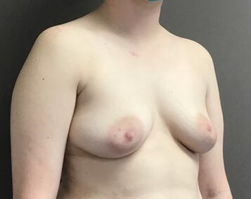 Oblique Before