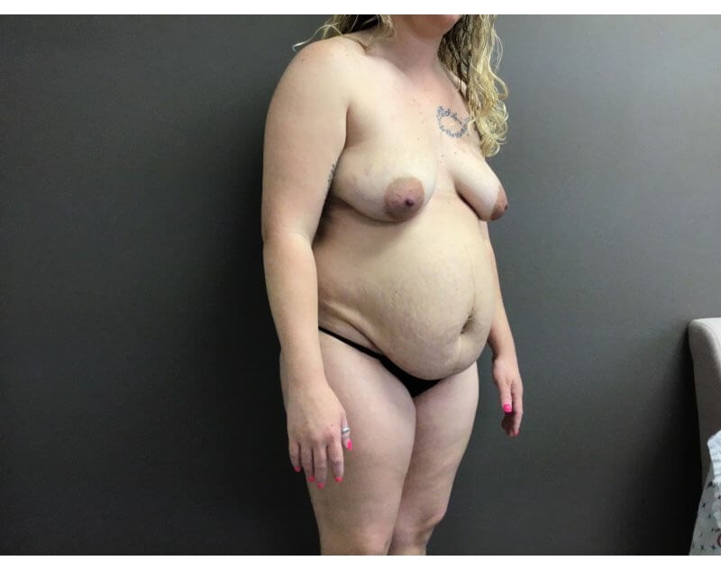 Oblique Before
