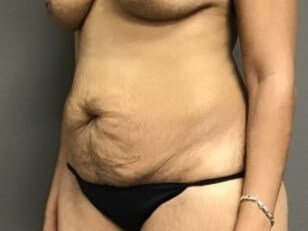 Oblique Before