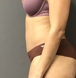 Side After
