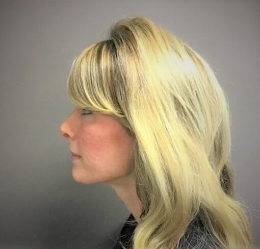 After Image