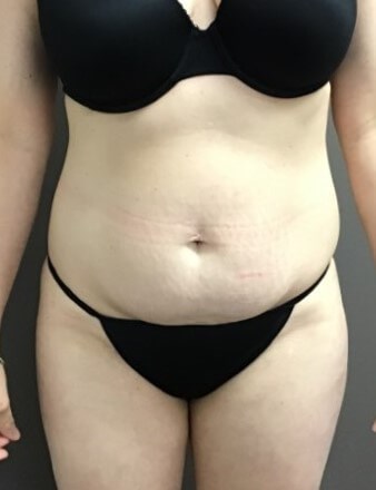 Before Image