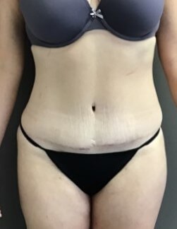 After Image