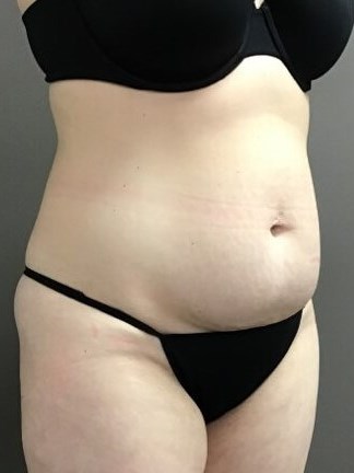 Oblique Before